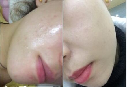 日系爽肤水推荐,十大公认最好的爽肤水价格