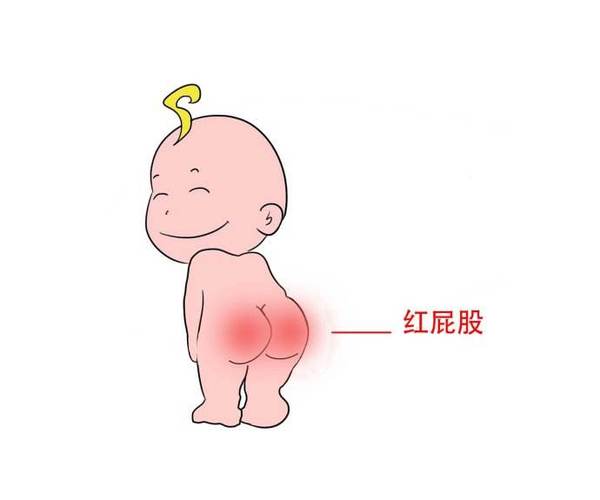 宝宝有点红屁屁怎么护理,宝宝红屁屁了怎么护理