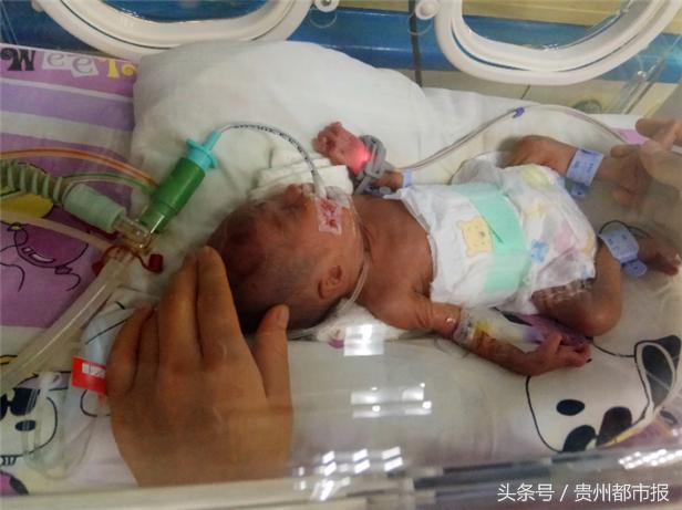 救救温箱里的孩子！贵阳孕妇26周早产，每天要花3-6千元