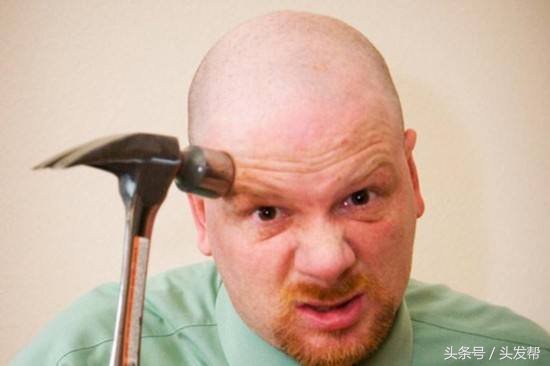 脱发到底都是什么原因，都有哪些原因？你又中招了吗？