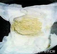 宝宝便便说明健康,宝宝便便有奶瓣颗粒还是绿色的