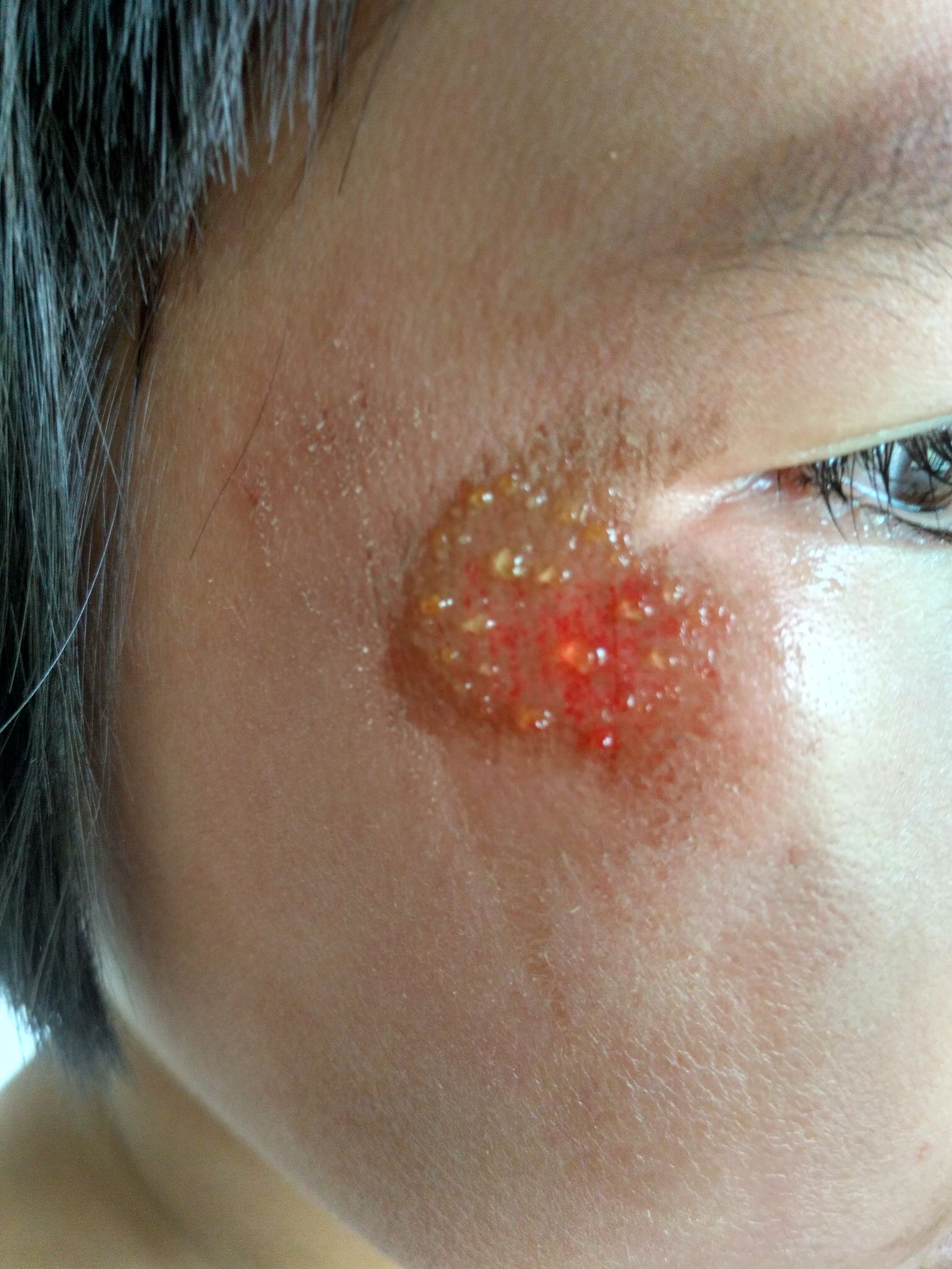 女儿摔破皮心疼,女儿脸摔肿了怎么办