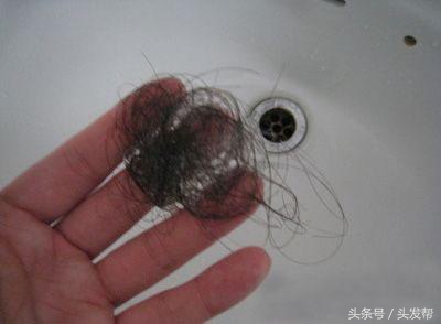 脱发到底都是什么原因，都有哪些原因？你又中招了吗？