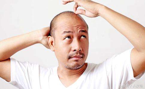 脱发到底都是什么原因，都有哪些原因？你又中招了吗？