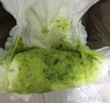 宝宝便便说明健康,宝宝便便有奶瓣颗粒还是绿色的