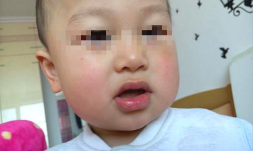 安抚奶嘴会不会把嘴巴变臭,宝宝长期吸安抚奶嘴嘴唇会变丑吗