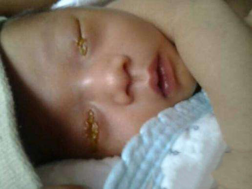 育儿经验差怎么办,奶水可以涂眼睛吗