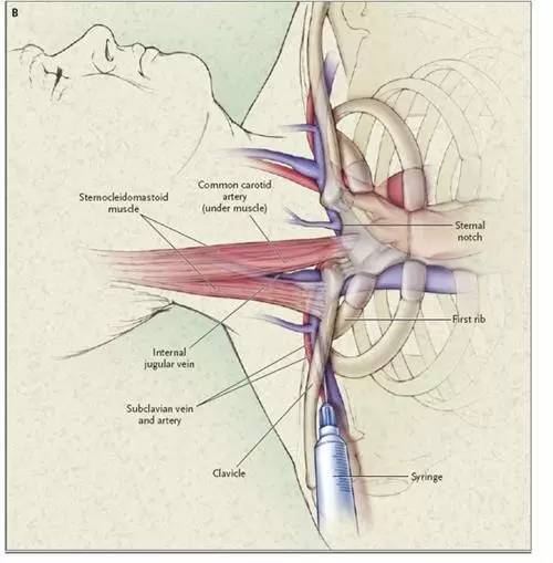 扎管的温度——北京医院肿瘤科护士手记｜有故事的人