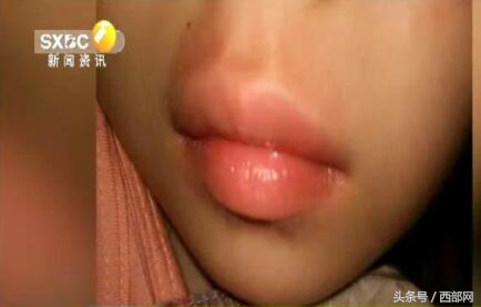 幼儿园老师给孩子嘴巴贴胶布,小朋友嘴巴被胶带粘住