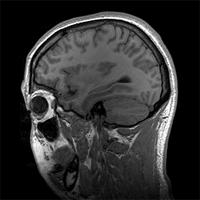 你有考虑过将来捐献器官救人吗,陈天桥为什么执着脑科学研究