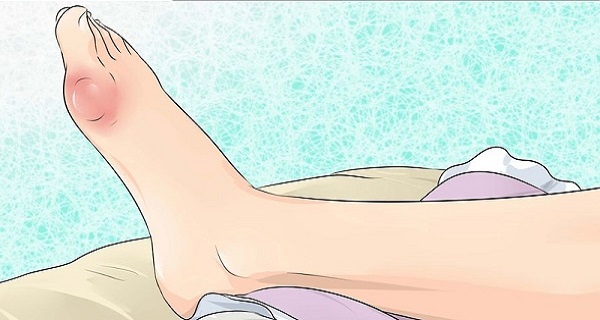 缓解痛风症状试试食疗偏方,有痛风病的人不吃哪些食物