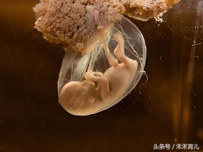 孕34周羊水过多畸形概率大吗,孕24周羊水破会流多少