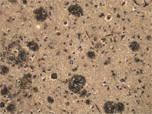 你有考虑过将来捐献器官救人吗,陈天桥为什么执着脑科学研究