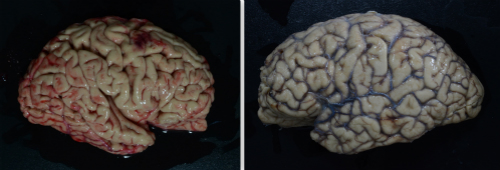 你有考虑过将来捐献器官救人吗,陈天桥为什么执着脑科学研究