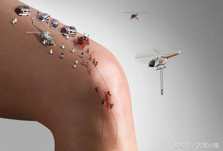 丑陋的疤痕布满整张脸,旧疤痕怎么去除最有效