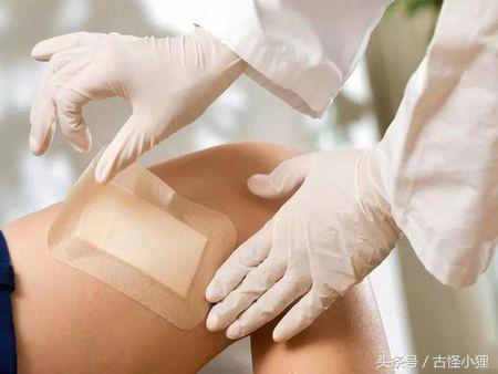 丑陋的疤痕布满整张脸,旧疤痕怎么去除最有效