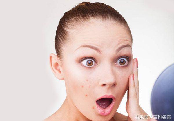 抗痘技巧,多年的痘痘肌怎么抗痘