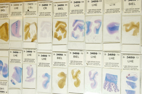 你有考虑过将来捐献器官救人吗,陈天桥为什么执着脑科学研究