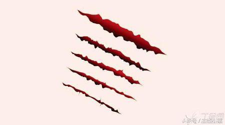 丑陋的疤痕布满整张脸,旧疤痕怎么去除最有效