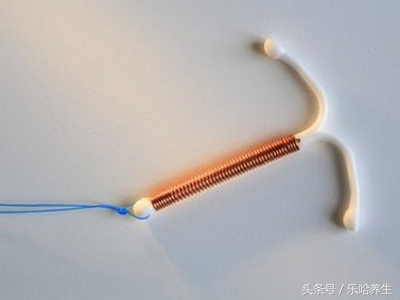 女性上环你真的了解吗,女性上环有没有对女性不好的伤害