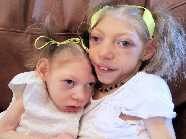 防治蚊虫叮咬的最好方法,蚊虫叮咬预防内服药物