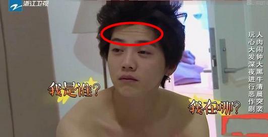 鹿晗素颜抬头纹,鹿晗15年跑男红衣