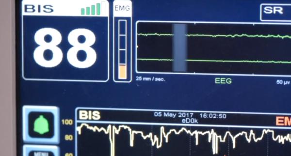 吸入笑气气体有什么危害,笑气的化学成分及其危害