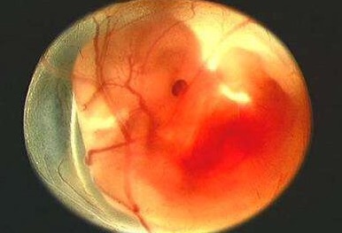 准妈妈怀孕早期的孕程须知