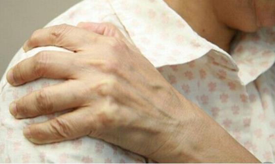 手麻脸麻警惕七个大病已盯上你,经常手麻的人要警惕八种疾病