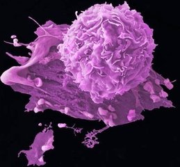 癌症运动对抗癌有效吗,抗癌运动每天30分钟抑制癌症复发