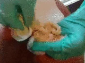 扰人的痘痘问题，你都可以解决！