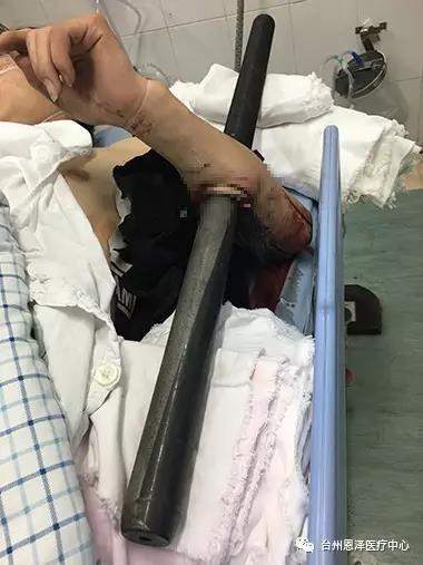 男子手臂被栏杆穿透防火救援,男子手被撞断惊险瞬间