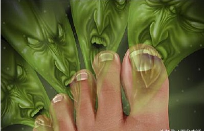 哪些人容易感染上脚气？特意为你找的治脚气食疗方法！