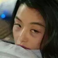 色斑暗沉没有光泽,遮不掉的黑眼圈祛不掉的痘印