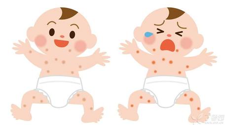 儿科医生宝宝湿疹怎么治,宝宝湿疹医生用药