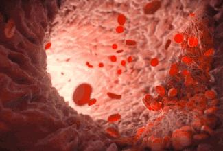 腰间盘突出治愈真实案例,腰间盘突出发病时正确锻炼方法