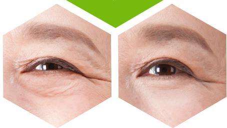 探讨一下眼霜到底有没有必要涂呢,你的眼霜用对了吗眼部护理