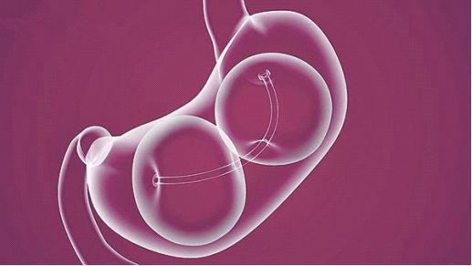 气球减肥最有效的方法,8-16小时减肥法