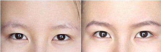 没有眉毛怎么办吃什么长出来,没有眉毛怎么办文案