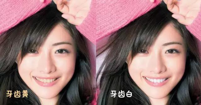 拥有一个好牙,拥有一口好的牙齿很重要