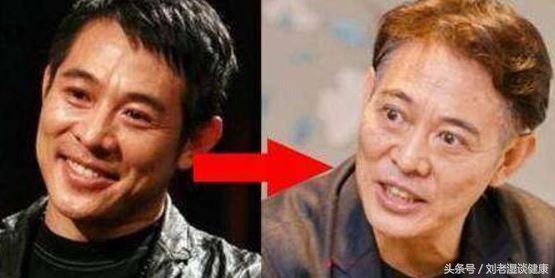 甲亢可怕还是甲减可怕,甲亢并非不治之症