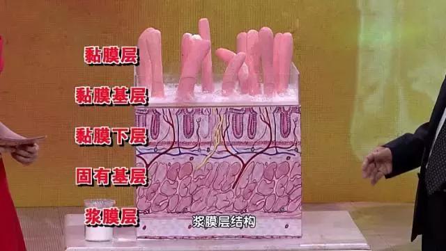 怎样保护胃不得胃癌,胃粘液屏障