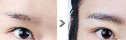 没有眉毛怎么办吃什么长出来,没有眉毛怎么办文案