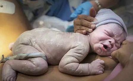 助产士不负责导致胎儿不好,助产士没有接住产道出来的新生儿