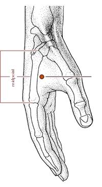 神经根型颈椎病的针灸理疗治疗,针灸治疗颈椎病能不能去根