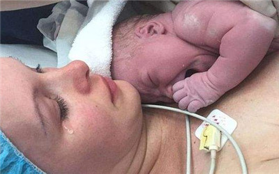 让过来人告诉你剖腹产到底啥滋味,谁说无痛分娩不会腰疼