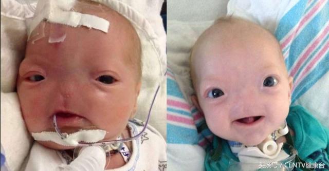 美国孩子刚出生没人带怎么办,美国婴儿出生不哭