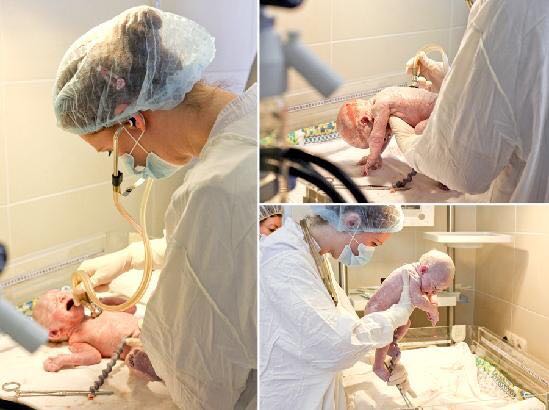 直击剖腹产全过程，看一次震撼一次心灵各位宝爸请珍惜