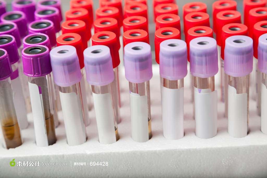 肿瘤治疗相关血小板减少治疗指南,化疗引起血小板降低怎么治疗