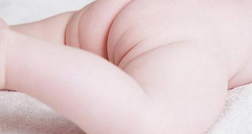 婴儿身上有痣和胎记,婴儿胎记和痣怎么区分